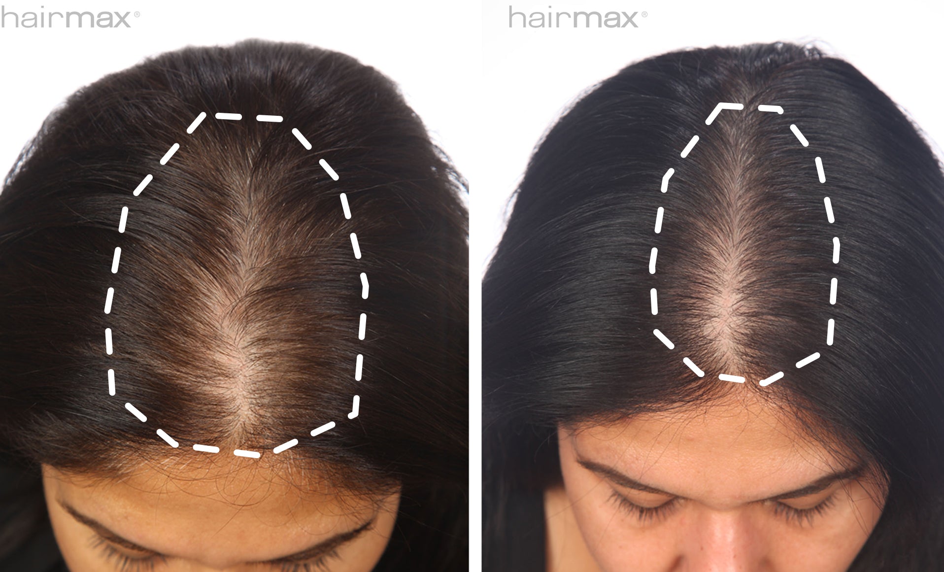 Marjorie Before & After