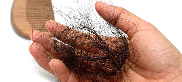 Causes and Treatments for Female Pattern Hair Loss